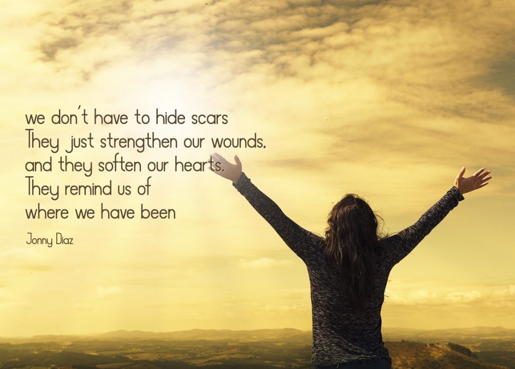 We don't have to hide scars. Article on losing children by Conexus Counselling